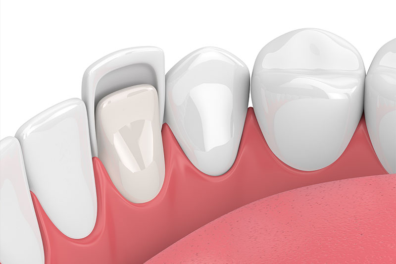 Cosmetic Dentistry in San Antonio